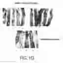 Fig. 08 - Compositions and methods to prevent cancer by stabilizing p53 through non MDM2-mediated pathways