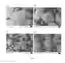 Fig. 02 - Method for the production of granules comprising surface-reacted calcium carbonate
