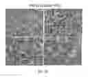Fig. 14 - siRNA compositions that specifically downregulate expression of a variant of the PNPLA3 gene and methods of use thereof for treating a chronic liver disease or alcoholic liver disease (ALD)