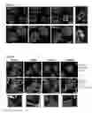 Fig. 07 - Methods and compositions for modulating AAV infection