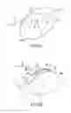Fig. 09 - Anchoring assembly