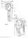 Fig. 72 - Pool Cleaner Filter Medium