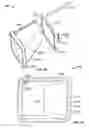Fig. 80 - Pool Cleaner Filter Medium