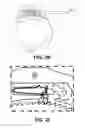Fig. 07 - Restraint condition detection and notification system, devices, and methods