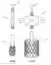 Fig. 06 - Expandable device for use in a well bore