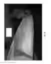 Fig. 09 - Multilayer coverings to protect surfaces from lightning strikes