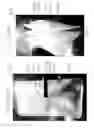 Fig. 14 - Massage chair having a noise-reducing, enclosure device