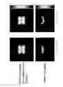 Fig. 08 - Receive coil arrangement and method for use thereof