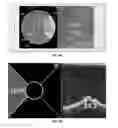 Fig. 08 - Devices and methods for locating and visualizing underwater objects