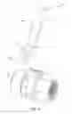 Fig. 06 - Externally adjustable flow management valve assembly and system