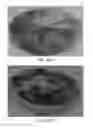 Fig. 22 - VEGETABLE PRODUCT FOOD HOLDERS