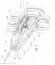 Fig. 06 - Semi-automatic biopsy needle device and methods of use