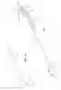 Fig. 06 - Biopsy needle devices and methods of use