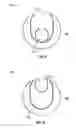 Fig. 07 - Dilation system