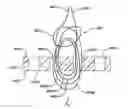 Fig. 01 - Implant having adjustable filament coils