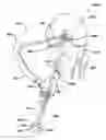 Fig. 01 - Universal surgical guide systems and methods