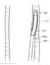 Fig. 01 - Systems and methods for endoluminal valve creation