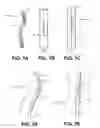 Fig. 02 - Systems and methods for endoluminal valve creation