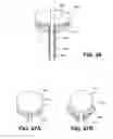Fig. 35 - Systems and methods for endoluminal valve creation