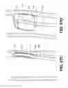 Fig. 44 - Systems and methods for endoluminal valve creation