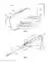 Fig. 02 - Electrosurgical instrument extension attachment