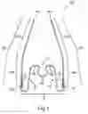 Fig. 02 - Apparatus for Applying Corrective Forces to Shape Palate