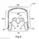 Fig. 03 - Apparatus for Applying Corrective Forces to Shape Palate