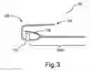 Fig. 04 - Apparatus for Applying Corrective Forces to Shape Palate