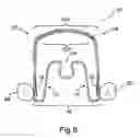 Fig. 07 - Apparatus for Applying Corrective Forces to Shape Palate