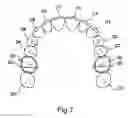 Fig. 08 - Apparatus for Applying Corrective Forces to Shape Palate