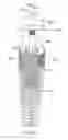 Fig. 07 - APPARATUS AND METHOD FOR ANATOMIC RESTORATION DENTAL IMPLANT HAVING A TWO-PIECE REINFORCED ZIRCONIUM DIOXIDE BASE AND TITANIUM INSERT