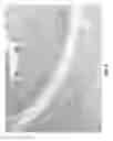 Fig. 06 - DEGRADABLE INTESTINAL ANCHOR