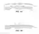 Fig. 02 - Implantable prosthesis having acellular tissue attachments