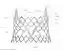 Fig. 02 - Radially collapsible frame for a prosthetic valve and method for manufacturing such a frame