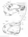 Fig. 03 - Adjustable and reversible locking mechanism for catheter-delivered implant
