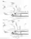 Fig. 06 - Adjustable and reversible locking mechanism for catheter-delivered implant