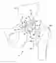 Fig. 01 - CUSTOMIZED PATIENT-SPECIFIC ORTHOPAEDIC INSTRUMENTS FOR COMPONENT PLACEMENT IN A TOTAL HIP ARTHROPLASTY