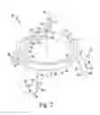 Fig. 03 - CUSTOMIZED PATIENT-SPECIFIC ORTHOPAEDIC INSTRUMENTS FOR COMPONENT PLACEMENT IN A TOTAL HIP ARTHROPLASTY