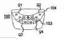 Fig. 01 - Artificial cervical and lumbar discs, disc plate insertion gun for performing sequential single plate intervertebral implantation enabling symmetric bi-disc plate alignment for interplate mobile core placement