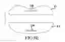 Fig. 20 - Artificial cervical and lumbar discs, disc plate insertion gun for performing sequential single plate intervertebral implantation enabling symmetric bi-disc plate alignment for interplate mobile core placement