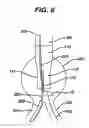 Fig. 07 - Cannulation guiding device for bifurcated stent and method of use