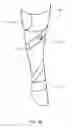 Fig. 06 - Foot ankle orthoses