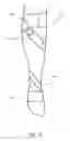 Fig. 07 - Foot ankle orthoses