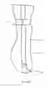 Fig. 09 - Foot ankle orthoses