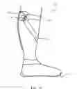 Fig. 22 - Foot ankle orthoses