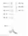 Fig. 04 - INTRAOCULAR DELIVERY DEVICES AND METHODS THEREFOR