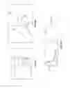 Fig. 14 - INTRAOCULAR DELIVERY DEVICES AND METHODS THEREFOR