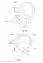 Fig. 34 - INTRAOCULAR DELIVERY DEVICES AND METHODS THEREFOR