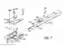Fig. 05 - Implantation assembly for an iris-expanding device