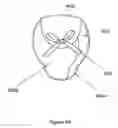 Fig. 13 - Article for receiving a body of an animal